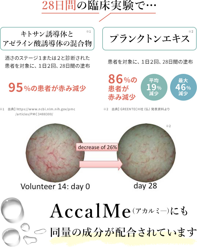 28日間の臨床実験で…キトサン誘導体95%の患者が赤み減少_プランクトンエキス86%の患者が赤み減少_AccalMe(アカルミ―)にも同量の成分を配合しています。